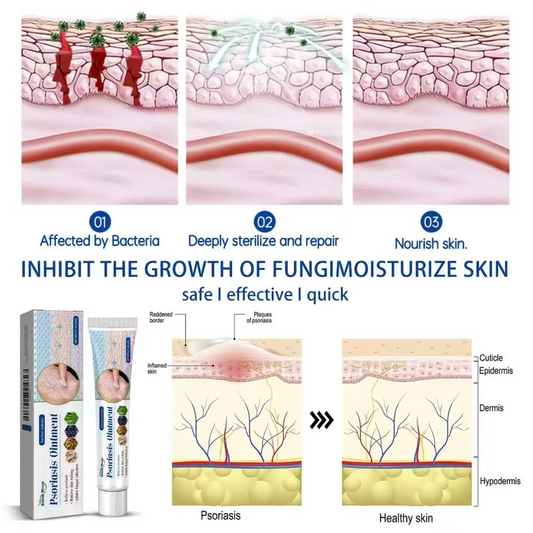 Soothing Antifungal Cream: Fast-Acting Jock Itch & Ringworm Treatment.