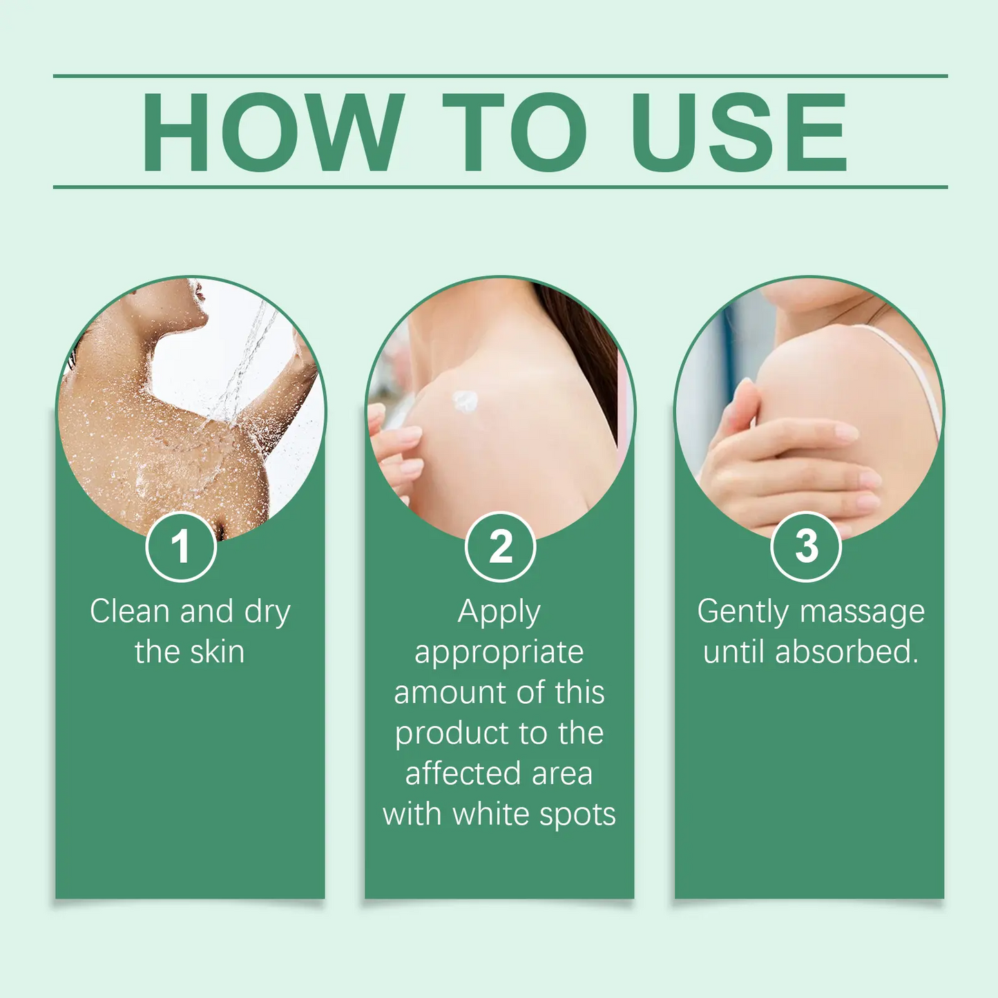 Vitiligo Treatment Cream, Improve Skin Pigmentation, Natural Formula, Suitable for All Skin