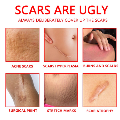 Professional Scar Removal Gel