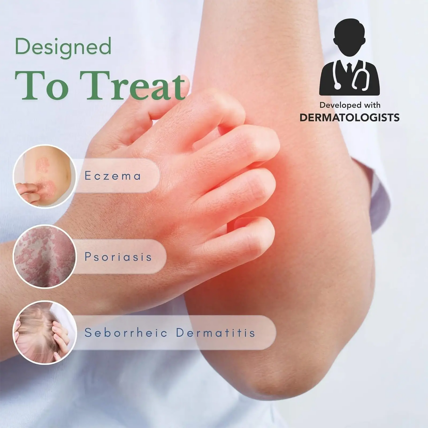 Eczema Cream - Natural Herbal Ointment for Itch Relief- 30g  body glaze Therapeutic  Healthy