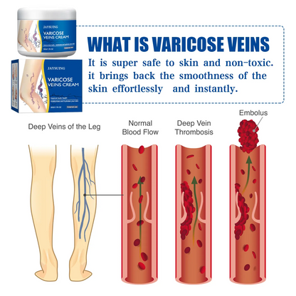 Exercise Repair Relieve Veins Leg Repairing Cream Mild Leg Massage Soothing Body Care Leg Relief External Use
