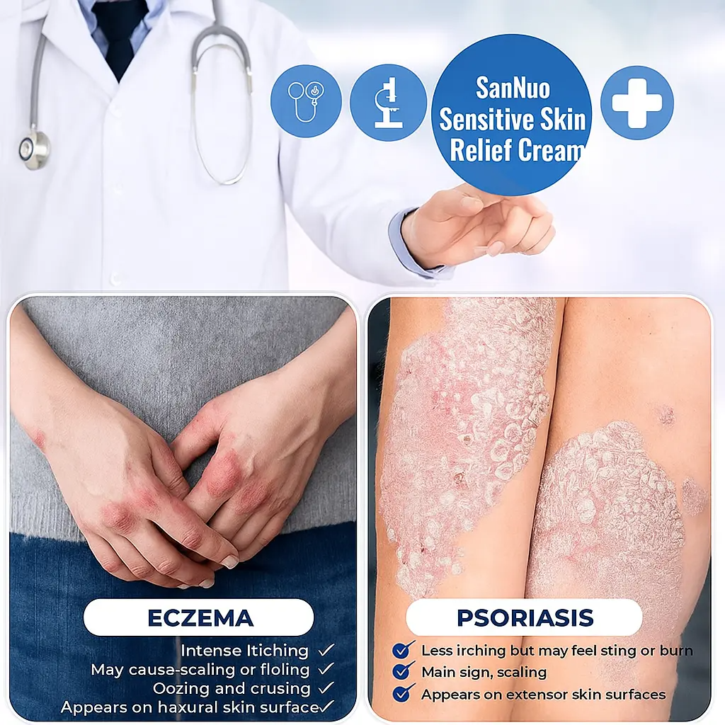 Calming Antimicrobial Cream - Soothes Eczema Flare-Ups, Jock Itch, Dry Itchy Skin | Fragrance-Free Mild Formula for Legs, Hands, Groin & Full Body