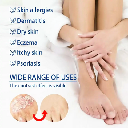 Soothing Antifungal Cream: Fast-Acting Jock Itch & Ringworm Treatment.