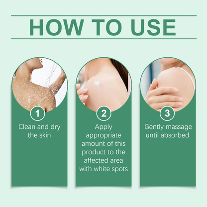 Vitiligo Treatment Cream, Improve Skin Pigmentation, Natural Formula, Suitable for All Skin